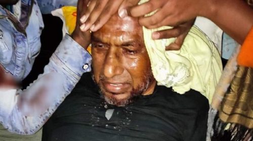 গুরুদাসপুরে সাবেক উপজেলা চেয়ারম্যান ও বর্তমান উপজেলা বিএনপির সভাপতিকে কুপিয়ে জখম